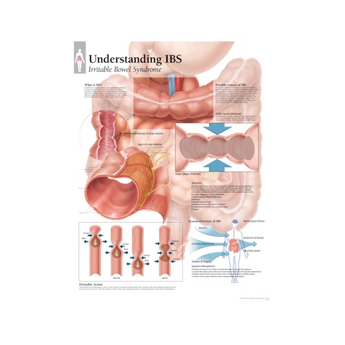 Understanding IBS