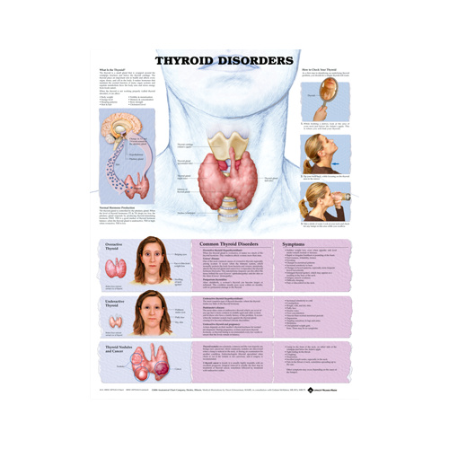 Anatomical Chart- Thyroid Disorders 