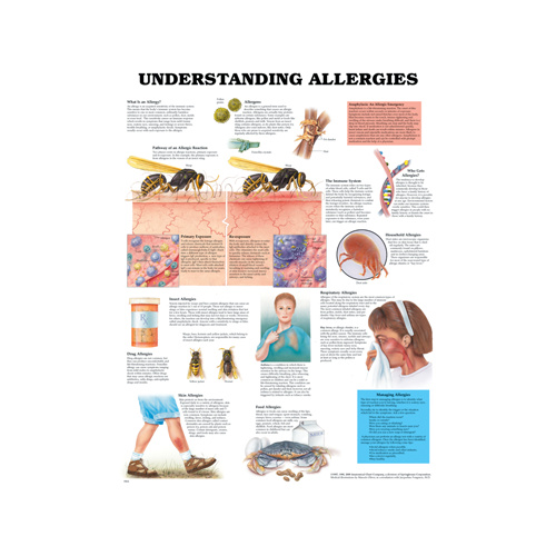 Anatomical Chart- Understanding Allergies 