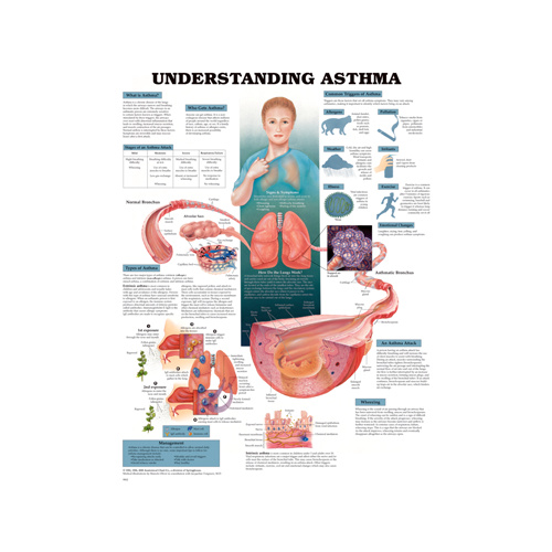 Anatomical Chart- Understanding Asthma