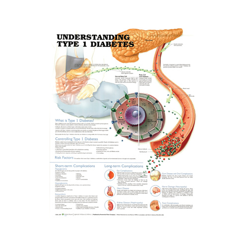 Anatomical Chart- Understanding Type 1 Diabetes 