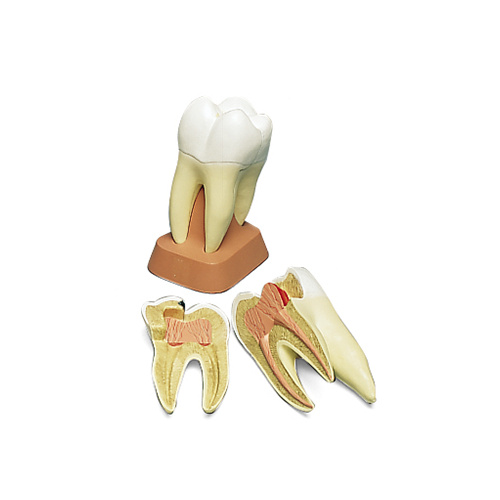 Anatomical Upper Triple Root Molar (2pt) Model