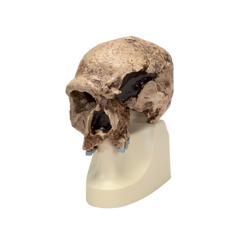 Anatomical Skull, Steinheim model