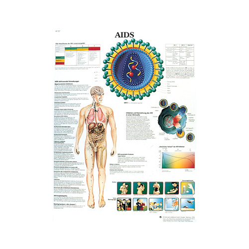 Anatomical Models of AIDS Chart