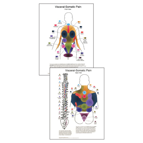 Visceral Referral Patterns Chart