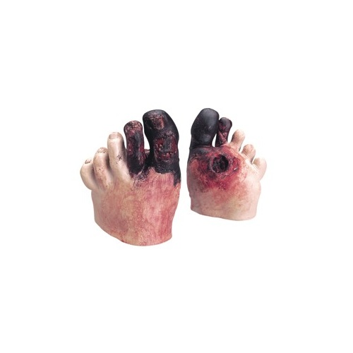 Unhealthy Foot Care Kit