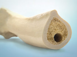 Orthopaedics