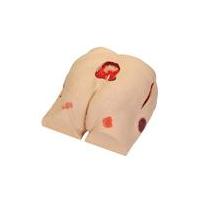 Wound Care